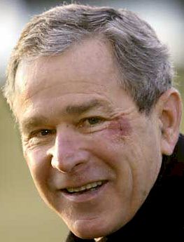 bushbruise.jpg (16737 bytes)